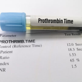 Protrombin Zamanı (Koagülometre)