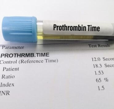 Protrombin Zamanı (Koagülometre)