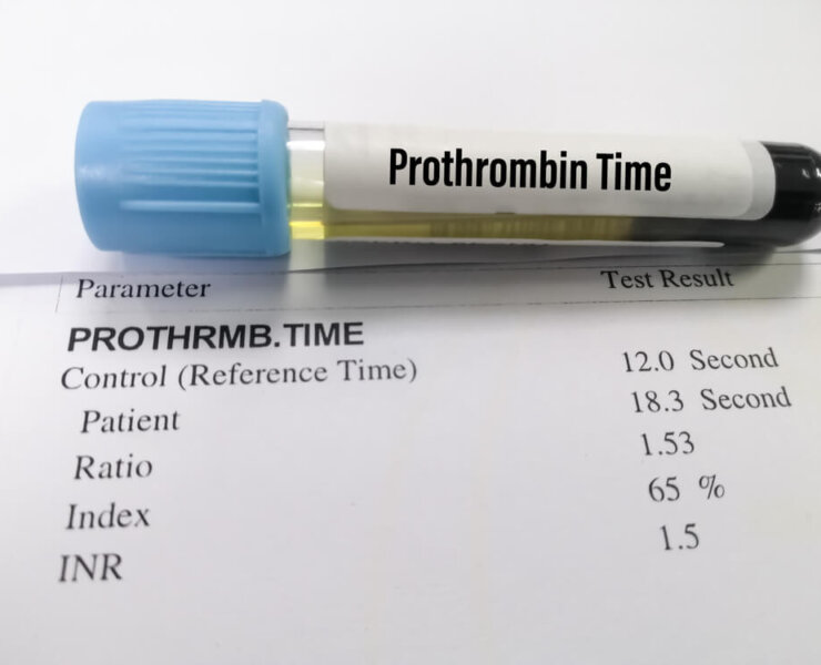 Protrombin Zamanı (Koagülometre)