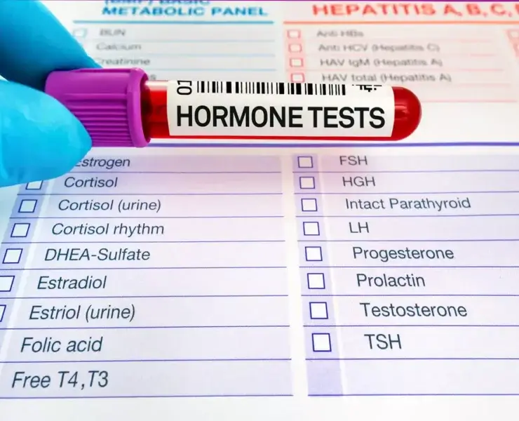 Hormon Testi Ne Zaman Yapılır