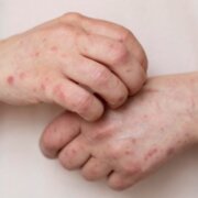 Artis Yang Mirip Monyet