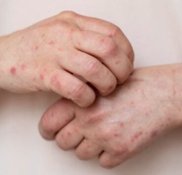 Artis Yang Mirip Monyet