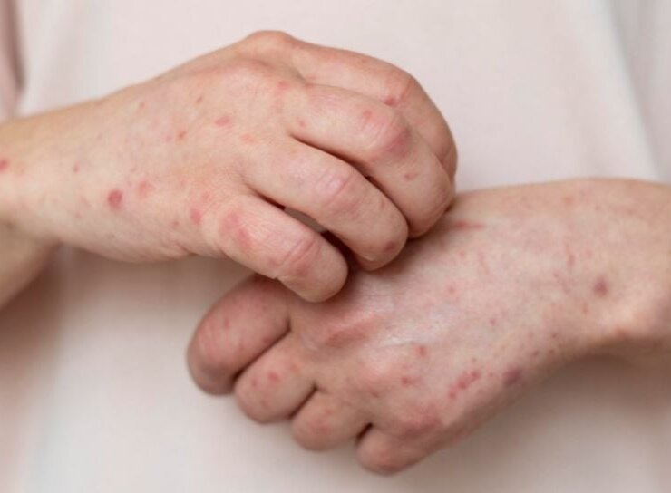 Artis Yang Mirip Monyet