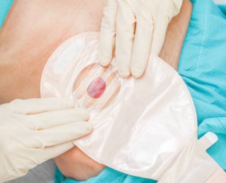 Natura Closed End Pouch With Filter